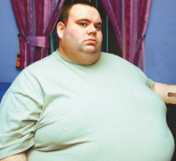 脂肪肝患者也能轻松减肥，有脂肪肝可以吃赛乐赛减肥药
